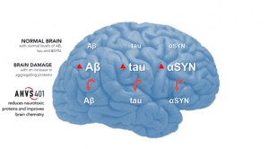 Can Annovio Bio Deliver a Breakthrough in Alzheimer’s Disease?